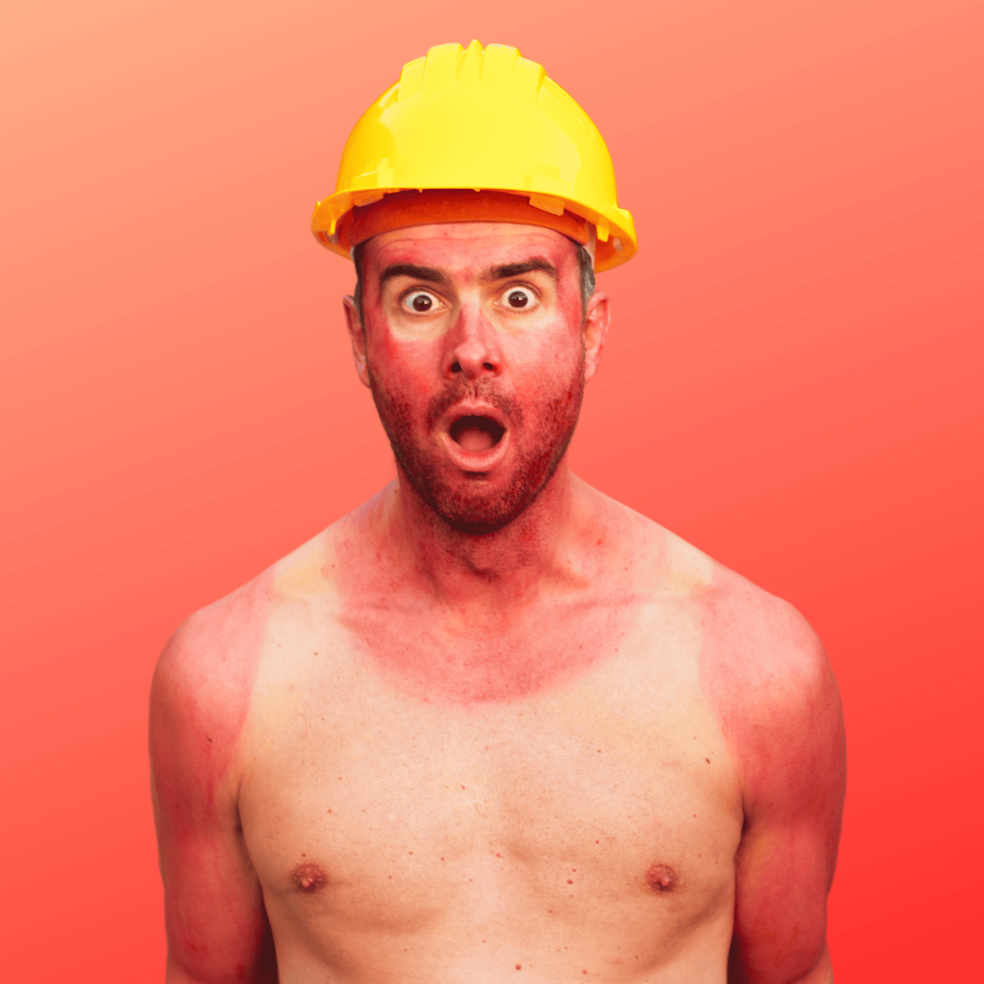 Sunburnt Construction Worker | RediMed