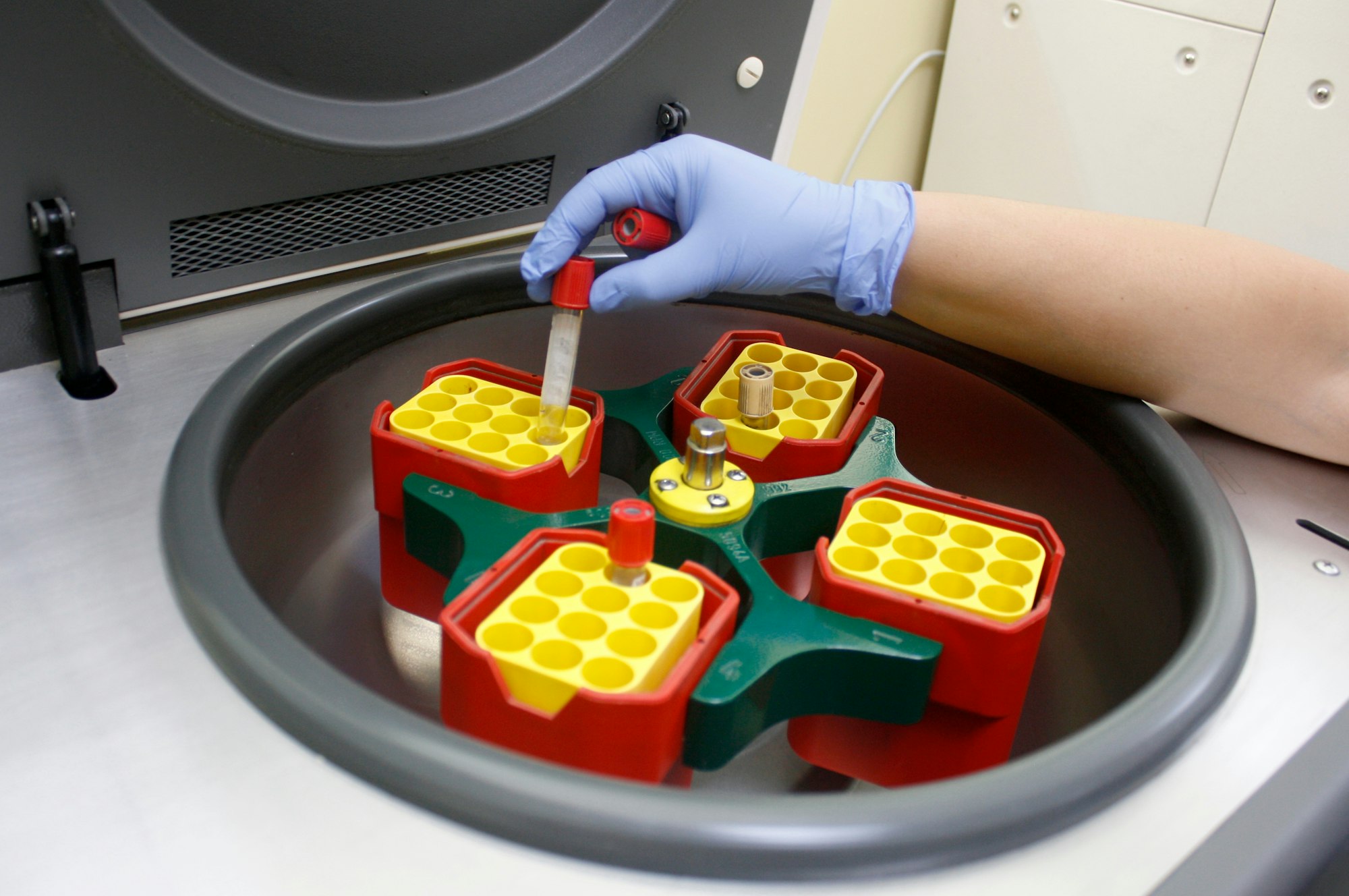 Blood test machine in medical lab